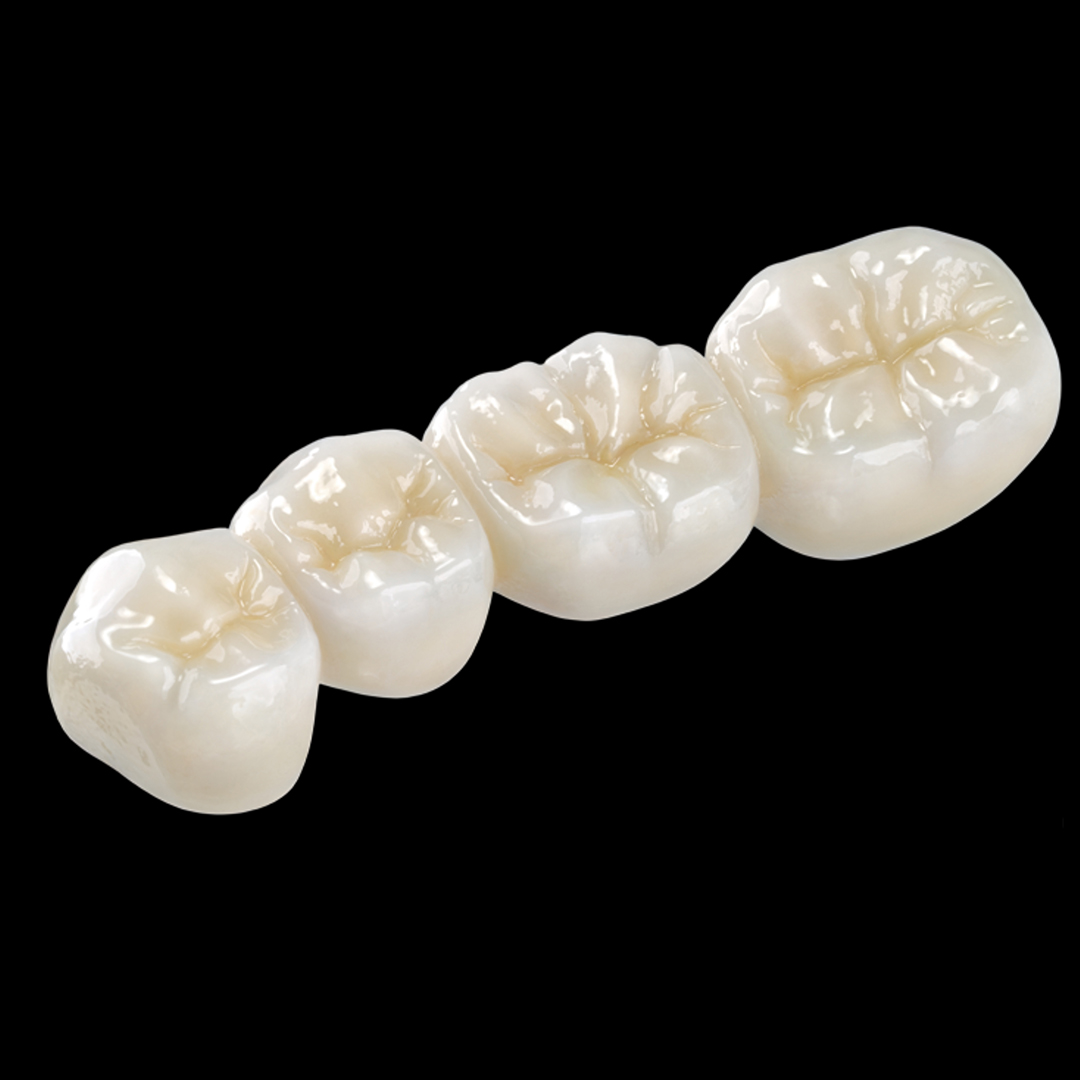 Clinical Strength Zirconia Full Bridge