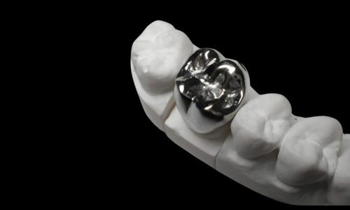 Metal Casting Alloy Cr-Co Full Metal Crown