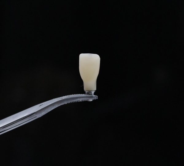 Implant Crowns & Bridges