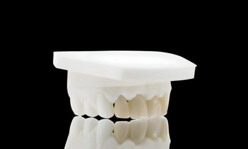 Porcelain Fused Zirconia Full Anterior Bridge