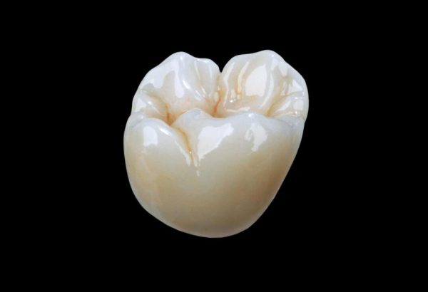 Bruxzir Esthetic Monolithic Full Crown
