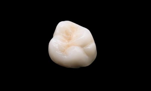 Zirco Clinical Esthetic Zirconia Full Crown