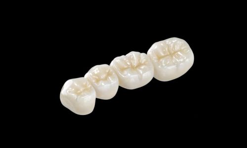 Zirco Clinical Strength Zirconia Full Bridge