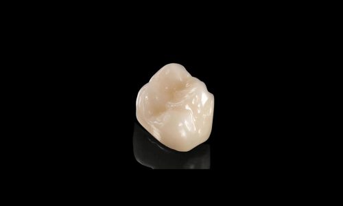 Emax ZirCad Esthetics Monolithic Full Contour Crown