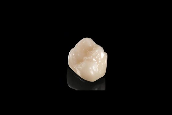 Emax ZirCad Esthetics Monolithic Full Contour Crown