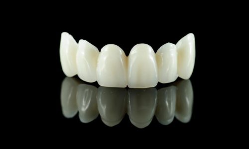 Lava Plus High Strength Monolithic Full Bridge