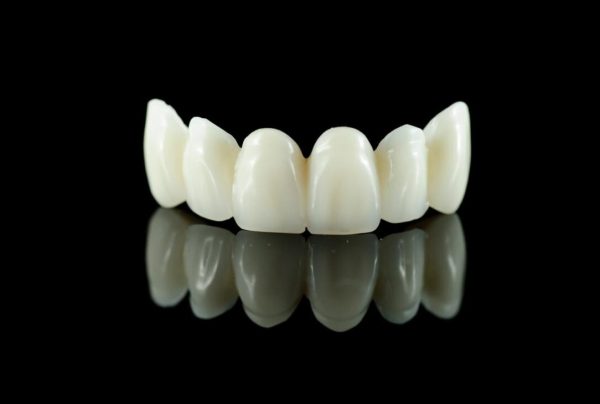 Lava Plus High Strength Monolithic Full Bridge