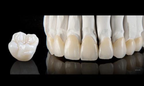 Lava Plus High Translucency Monolithic Full Crown