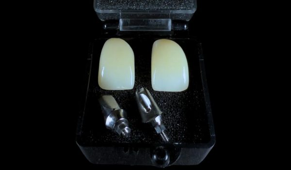 Custom Manufacturer Abutments