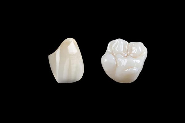 Porcelain Fused Zirconia Crown